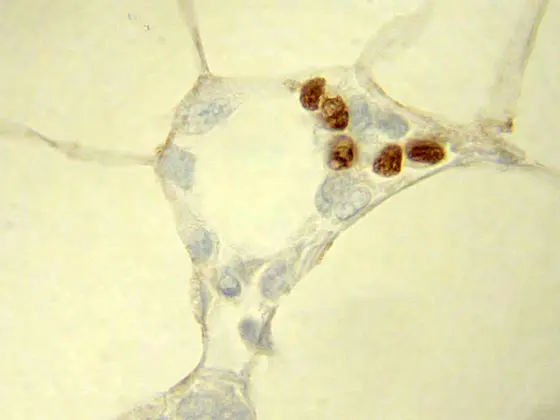 Schnitt durch das Bauchfettgewebe einer Maus. Braun eingefärbt sind die Kerne der entzündungshemmenden regulatorischen T-Zellen.
