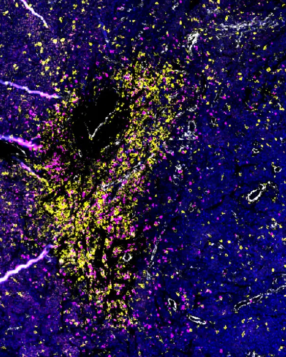 A microscopic image displaying a dark background with vibrant clusters of yellow and pink particles, representing immune cells in brain tissue. The colors highlight the distribution and interaction of these cells, crucial for understanding their role in neurological conditions.