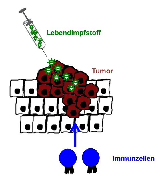 Wird der aus Viren bestehende Lebendimpfstoff “Candid#1“ in Tumoren (rote Zellen) injiziert, lockt er Immunzellen an, die den Tumor bekämpfen.