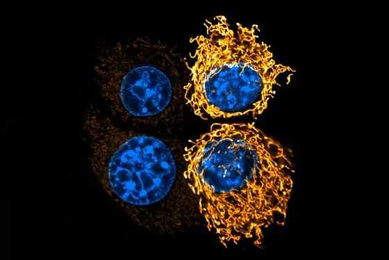 Die Abbildung zeigt vier Zellen, die in zwei Gruppen angeordnet sind. Zwei Zellen sind blau und rund, während die anderen zwei in Gelb leuchten und eine unregelmäßige Form haben. Der Hintergrund ist schwarz, was die Farben der Zellen hervorhebt.