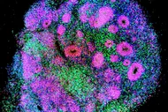 Mikroskopisches Bild eines gefärbten Gewebestücks, das eine Vielzahl von bunten Zellen und Strukturen zeigt, hauptsächlich in den Farben Lila, Grün und Blau. Die Darstellung zeigt verschiedene Zelltypen und deren Verteilung innerhalb des Gewebes.