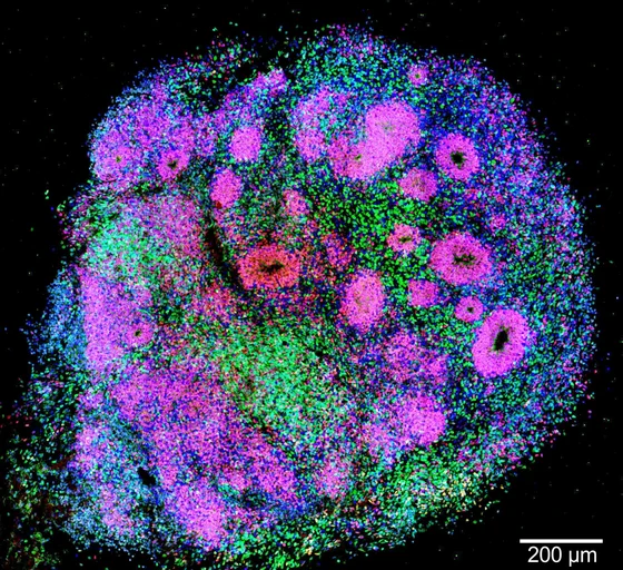 Mikroskopisches Bild eines gefärbten Gewebestücks, das eine Vielzahl von bunten Zellen und Strukturen zeigt, hauptsächlich in den Farben Lila, Grün und Blau. Die Darstellung zeigt verschiedene Zelltypen und deren Verteilung innerhalb des Gewebes.