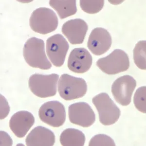 In roten Blutkörperchen bildet der Malaria-Erreger Plasmodium falciparum charakteristische ringförmige Strukturen.