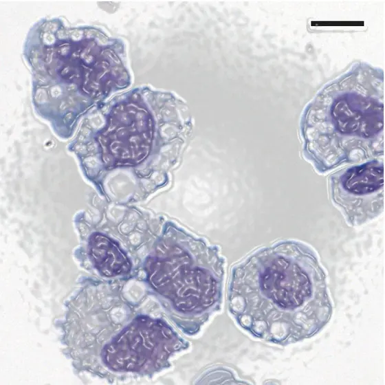 Mikroskopische Aufnahme von Makrophagen aus dem Dottersack. Makrophagen in erwachsenen Geweben stammen aus diesem frühen Stadium der Entwicklung und unterscheiden sich dadurch von allen anderen Zellen des Immunsystems, die aus Stammzellen im Knochenmark gebildet werden.