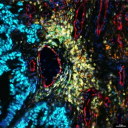 Mikroskopische Aufnahme von Gewebe mit lebendigen Farben, die verschiedene Zelltypen darstellen. Zu sehen sind blaue, grüne und rote Strukturen, die eine komplexe Strukturierung zeigen. Ein zentraler Bereich ist dunkler gefärbt, während die Umgebung stark gefärbt ist.
