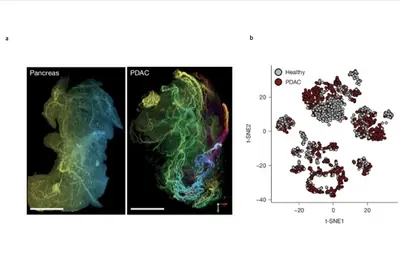 Tissue clearing, labeling and analysis of isolated single neurons.