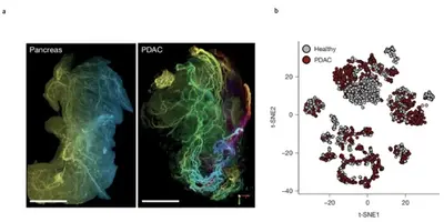 Tissue clearing, labeling and analysis of isolated single neurons.
