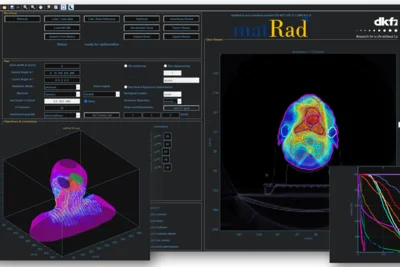 The image presents a graphical interface of the matRad software, showcasing various 3D radiation dose distributions and optimization curves associated with radiotherapy. It features colorful visual representations of an anatomical model, along with graphs indicating performance metrics for treatment planning.