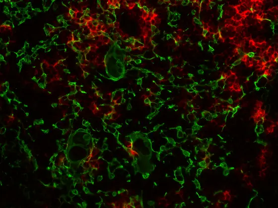 Gewebeschnitt durch den menschlichen Thymus: Verstreut zwischen den medullären Thymusepithelzellen (grün) liegen kleine Inseln von B-Zellen (rot).