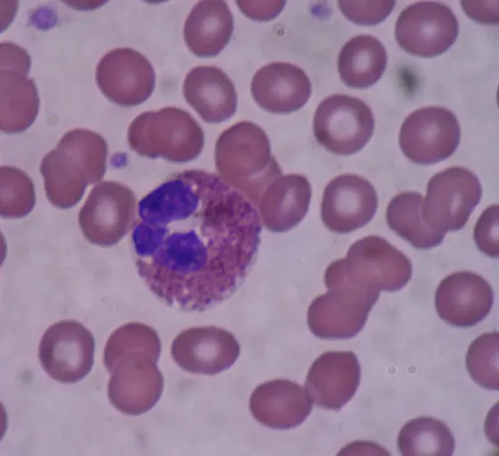 Mikroskopische Aufnahme eines Blutausstrichs: ein eosinophiler Granulozyt zwischen roten Blutkörperchen.
