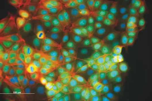 The image shows a microscopic view of cell structures, with prominent nuclei appearing in blue, surrounded by green cytoplasm and red filaments. The arrangement of the cells creates an intricate network, highlighting their organization and interaction. A scale bar indicates a distance of 100 micrometers.