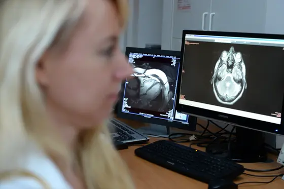 Eine Mitarbeiterin der NAKO-Gesundheitsstudie prüft MRT-Bilder am Monitor