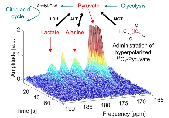 Die Abbildung zeigt ein 3D-Diagramm mit Amplitude über Zeit und Frequenz. Wichtige Punkte sind Pyruvat, Lactat und Alanin, die durch Pfeile hervorgehoben sind. Sie verdeutlichen die experimentelle Verfolgung dieser Metaboliten nach der Verabreichung von hyperpolarisiertem 13C1-Pyruvat.