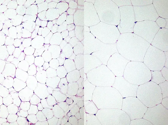 White adipose tissue of a lean (left) and an obese mouse