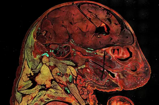A colorful fluorescence microscopy image shows a detailed cross-section of a developing embryo, highlighting various anatomical structures. The vibrant colors indicate different tissues and organs, providing insight into their arrangement and development stages.