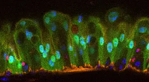 Schnitt durch den Darm der Taufliege Drosophila (Fluoreszenzmikroskopie): Die Darmepithelzellen sind grün mit blau-grünem Zellkern; die Stammzellen des Darms sind an ihrem dunkelblauen Zellkern zu erkennen.