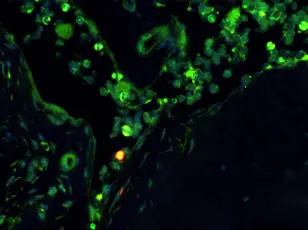 Blutstammzelle im Knochenmark (Maus)