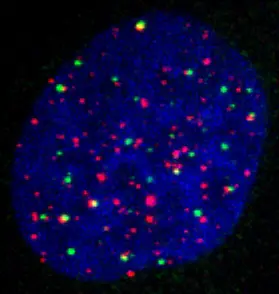 In manchen Krebszellen übernehmen die APB-Komplexe (gelb) nach jeder Zellteilung die notwendige Verlängerung der Chromosomenenden (rot).