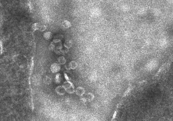 Aus der Zelle links werden gerade Wnt-Exosomen ausgeschleudert