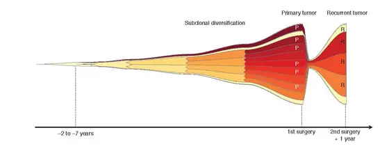 The evolution of a glioblastoma schematically illustrated