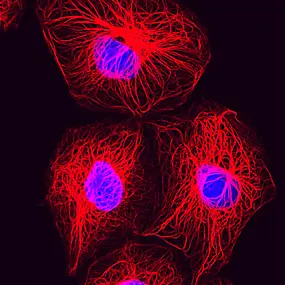 Breast cancer cells