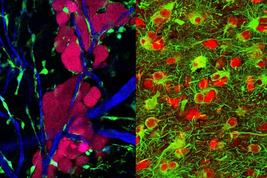 Die Abbildung zeigt zwei mikroskopische Ansichten des Nervengewebes. Linke Seite: rote und blaue Färbung von Nervenzellen und -strukturen. Rechte Seite: grünes und rotes Bild von dichten Zellansammlungen, die neuronale Aktivitäten darstellen. Diese Visualisierungen unterstützen die Forschung im Bereich Neuroonkologie.