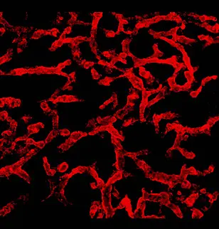 Menschliche Blutgefäße im experimentellen Mausmodell: Ausschalten des CCM1-Gens führt zu dem typischen, unorganisierten Erscheinungsbild