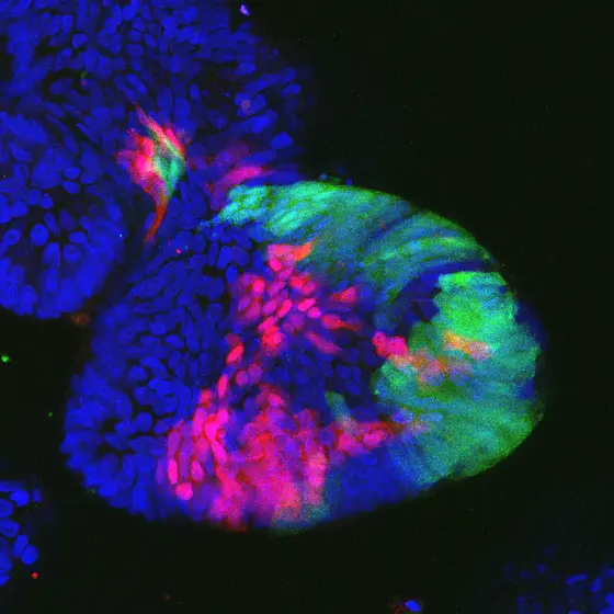 "Mini intestines" (colon organoids): After loss of the tumor suppressor gene cell regions are marked red and green.