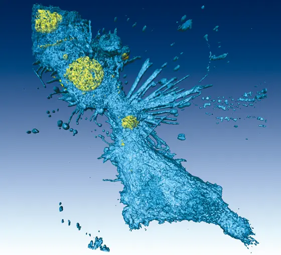 Lungenkrebszellen bei der Zellteilung