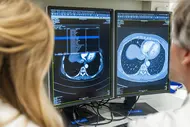 Zwei Fachleute betrachten CT-Scans des Brustkorbs auf zwei Computerbildschirmen. Die Scans zeigen die inneren Organe und Strukturen im Brustbereich. Eine Liste von Daten ist auf dem Bildschirm sichtbar, während die Fachleute auf die Bilder konzentriert sind.