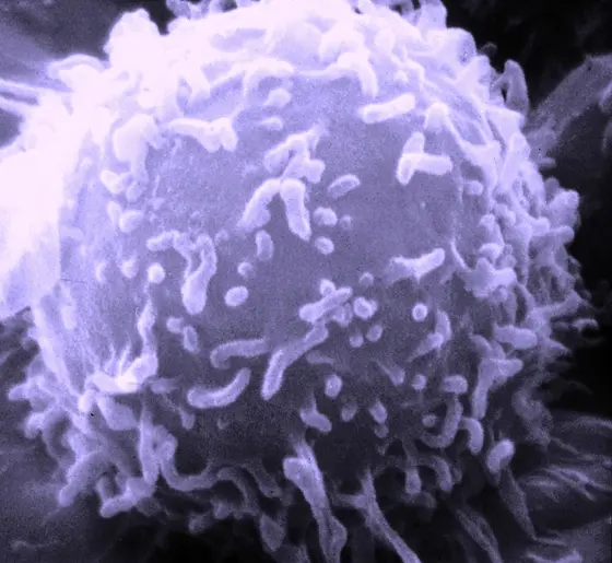 Rasterelektronenmikroskopische Aufnahme eines Lymphozyten.