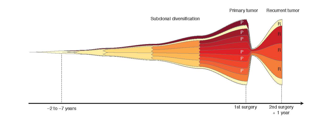 The evolution of brain tumors - German Cancer Research Center